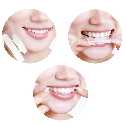 Smilumin – Komplekt hammaste hooldamiseks LED-valguse ja ribadega